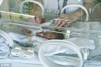 De te vroeg geboren Israëlische baby.